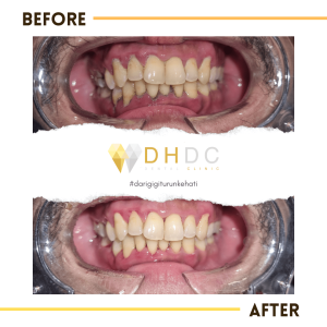 scaling gigi terdekat di jakarta