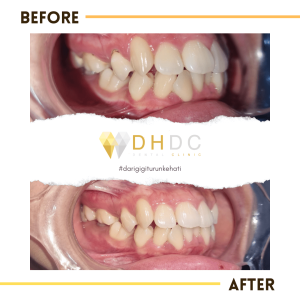 scaling gigi terdekat di tangerang