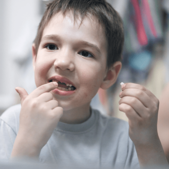 Kehilangan Gigi Alias Gigi Copot