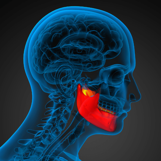 Tulang Rahang Gigi Menyusut