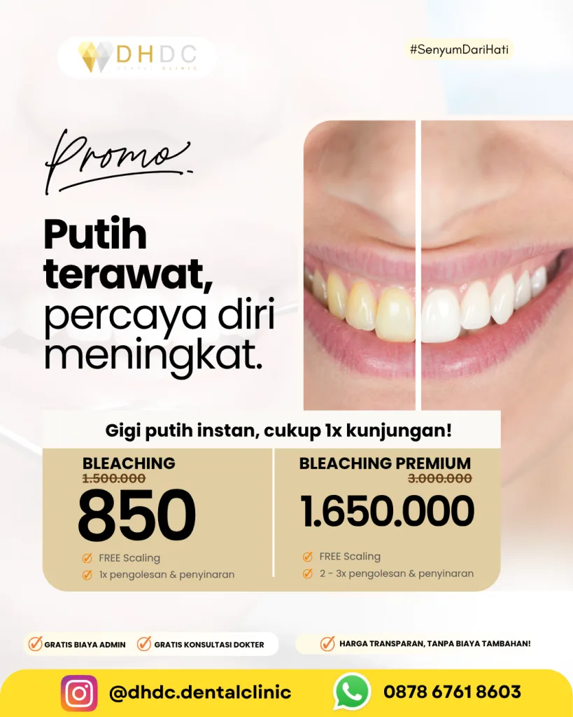 promo bleaching gigi murah terdekat di jakarta