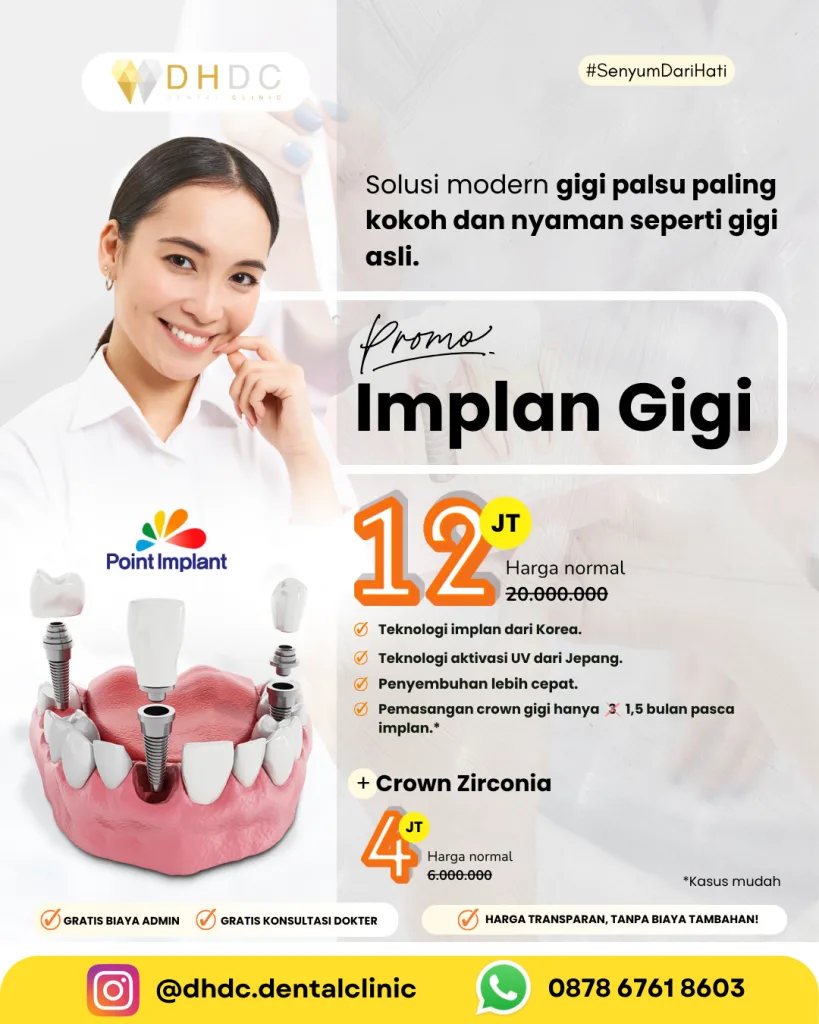 promo pasang implan gigi palsu terdekat di jakarta