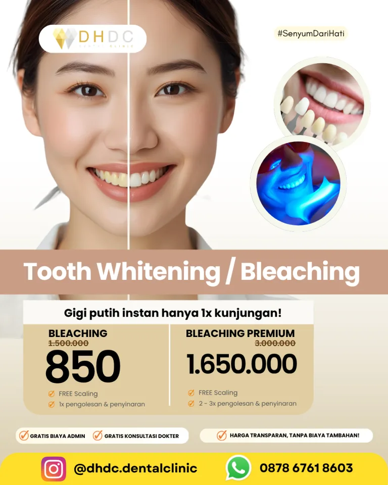 klinik dokter bleaching gigi terdekat di jakarta