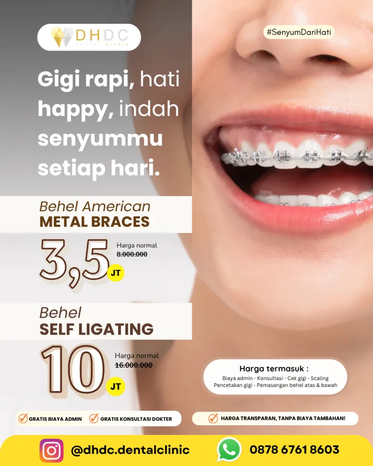 promo pasang behel gigi murah terdekat di jakarta