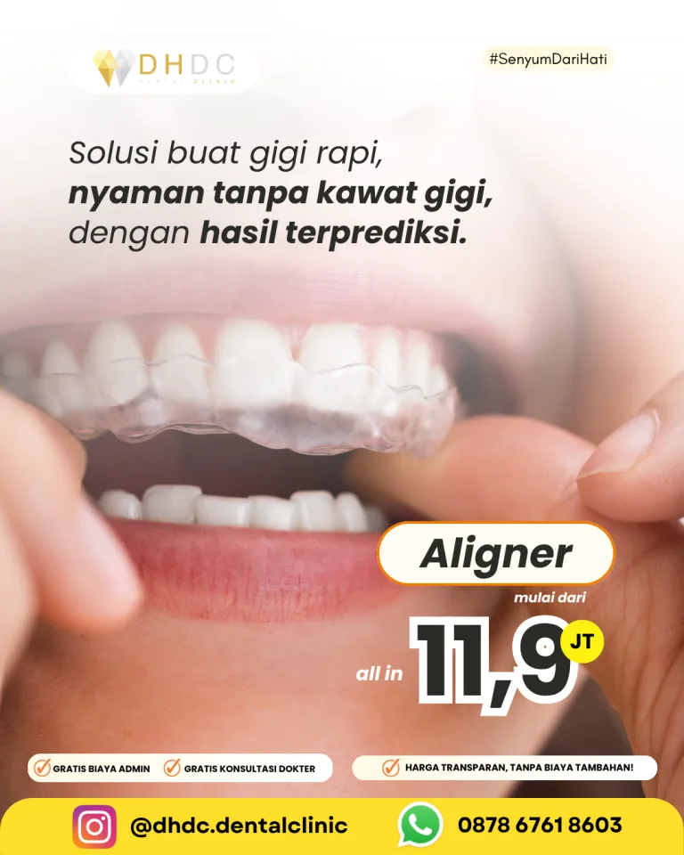 promo pasang aligner gigi murah terdekat di jakarta