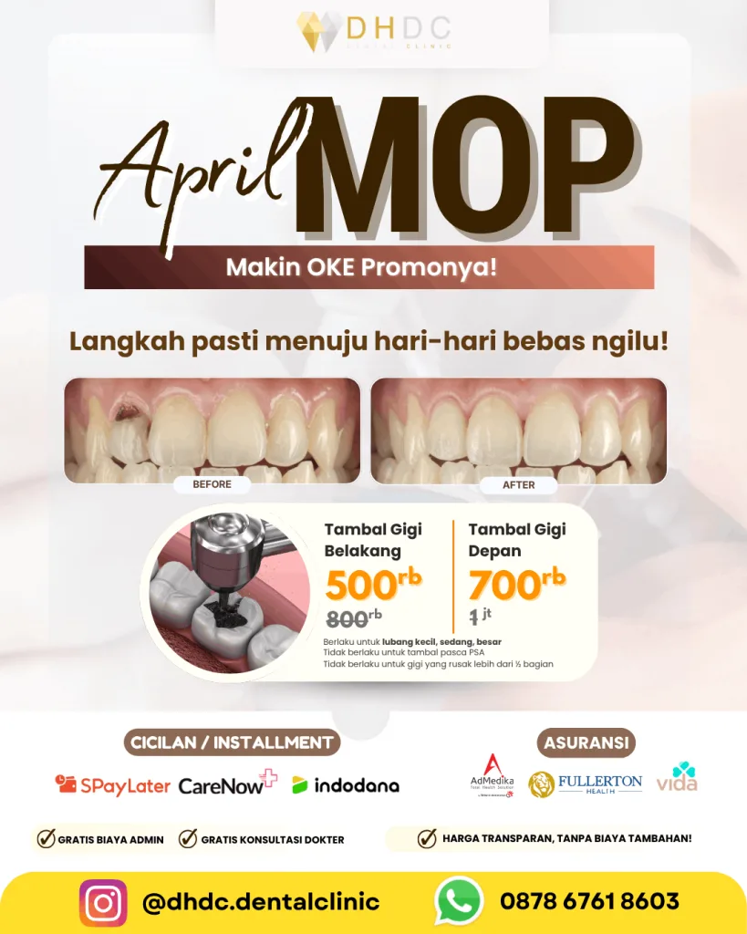 promo tambal gigi belakang murah terdekat di depok