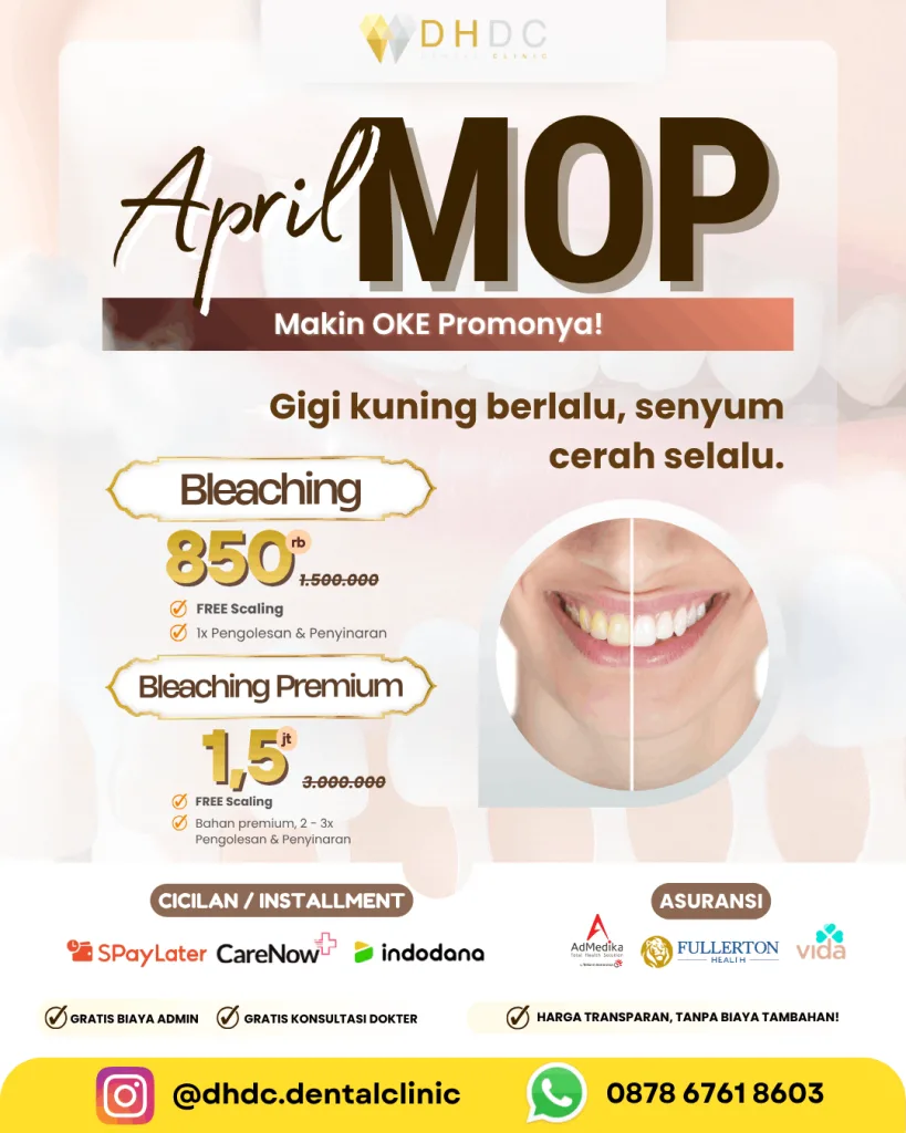 promo bleaching gigi murah terdekat di jakarta