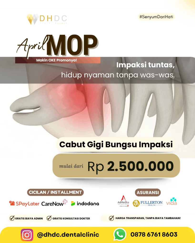 promo operasi gigi bungsu murah terdekat di jakarta